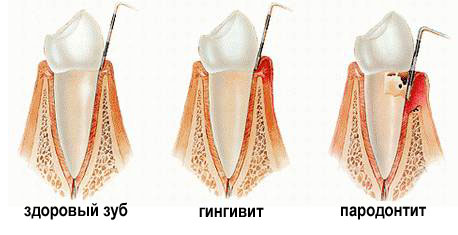parodontology.jpg